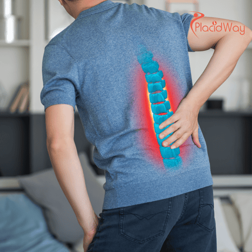 Spinal Fusion in Turkey: A Patient's Guide to Top Hospitals and Neurosurgeons